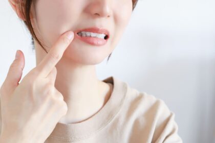 歯の治療を悩む女性